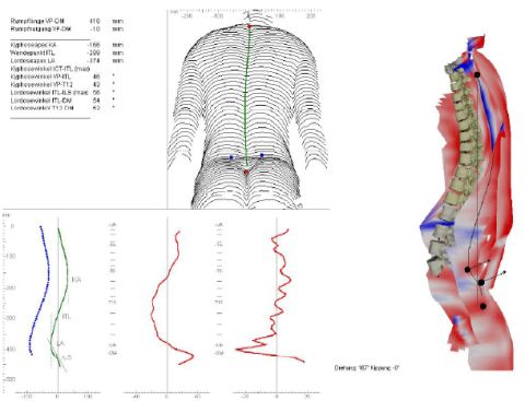 Formetric analisi curvature sul piano sagittale