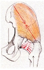 collo femore e muscoli glutei