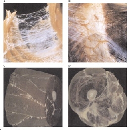 fascia connettivale - sistema miofasciale