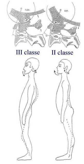 classi schletriche I e II