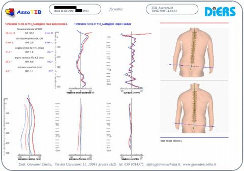 Analisi Formetric Blocco Lombare prima e dopo trattamento TIBpdywork