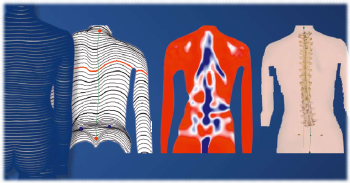 spinometria formetric 4D+