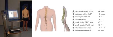Formetric 4d+ spinometria referto