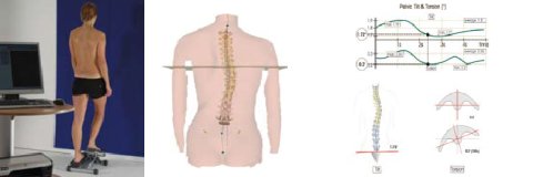 sistema Formetric 4D+ (spinometria)
