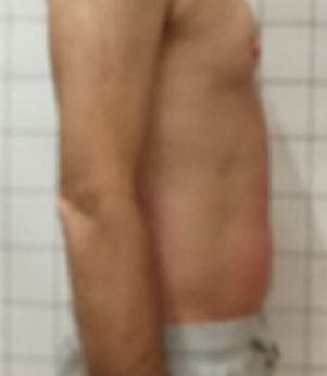Dopo